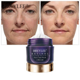 BREYLEE Retinol FirmingFaceCreamLifting Neck Anti-aging Remove Wrinkles Night Day Cream Moisturizing Facial Serum Korea SkinCare