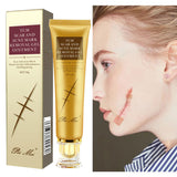 Acne Scar Removal Cream Repair Stretch Marks Gel Remove Burn Scars Surgical Scar Repair Treatment Smoothing Body Skin Care 30g